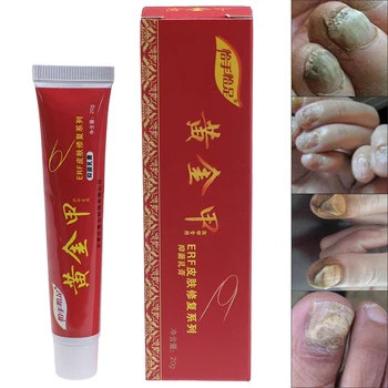 

Nail Fungal Removal Cream Treatment Onychomycosis Paronychia Anti Infection Feet Toe Nail Care Gel Fungal Nail Product
