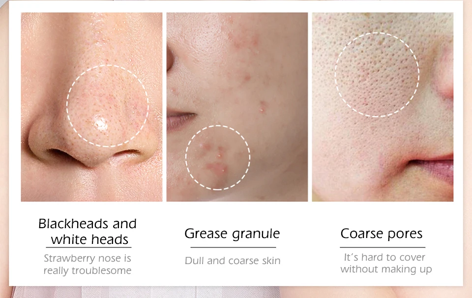 美康粉黛海盐泡泡面膜_03