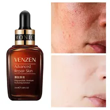 

Face Serum Primer Whitening Moisturizing Brightening Anti-aging Diminishing Pores Hyaluronic Acid Niacinamide Skin Care 30ml