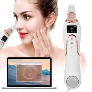 

Visual Pore Cleanser Electric Face Blackheads Pimples Removal Vacuum Suction Instrument Facial Cleaning Machien Tools for Home