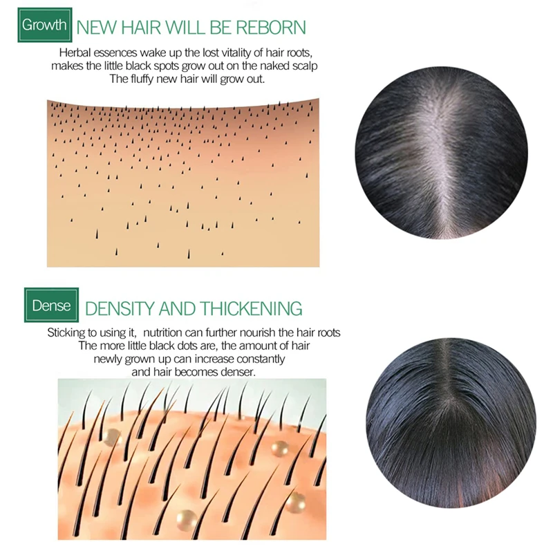 7 дней имбирь Germinal сывороточная эссенция масло естественного выпадения волос Treate men t эффективный быстрый рост Уход за волосами 30 мл для мужчин и женщин