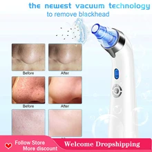 

Muti-Tool Beauty Facial Cleaning Skin Care Blackhead Remover Usb Rechargeable Water Cycle Acne Pimple Removal Black Dot Machine