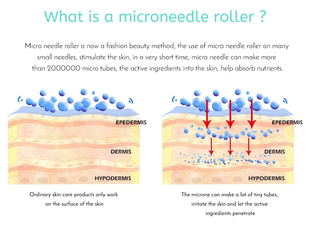 540 Derma ролика 0,2/0,25/0,3 мм титановые иглы мезороллер микро-иглы ролик для средств по уходу за кожей для ухода за волосами, Лечение выпадения ежедневного ухода, маникюрный набор