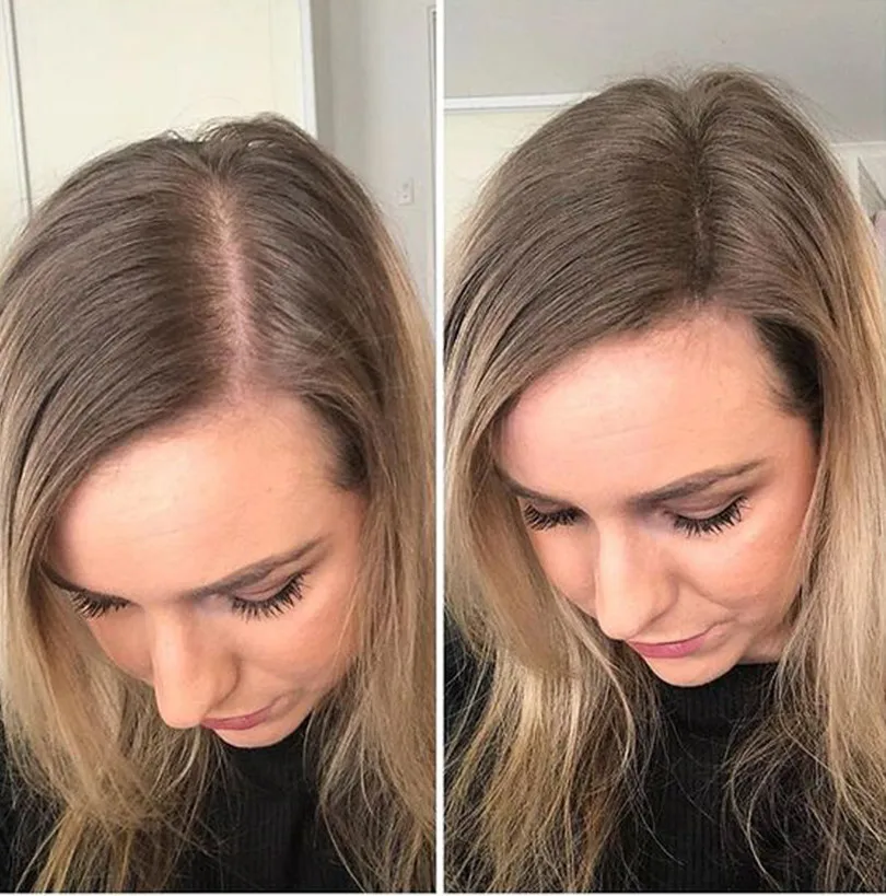 Pelo de tupé rubio ceniza degradado para mujer, peluquín con cierre 613, peluca Kosher, cabello europeo Remy, pieza superior