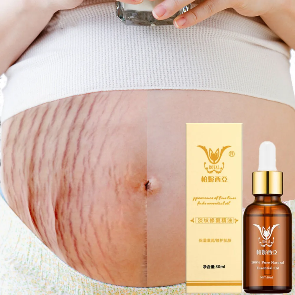 Stretch Marks Removal Essential Oils Pure Natural Stretch Marks Remover