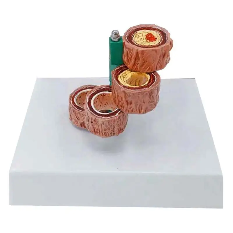 Кровеносный сосуд упрочнение артерий модель артериосклероза анатомическая