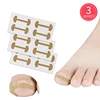 12Pcs G115