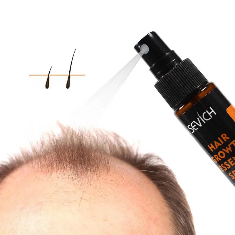 Barato Productos de queratina para crecimiento del cabello, Spray de fibras naturales para crecimiento del cabello, sin efectos laterales, productos para el cuidado del cabello 531y0Baaq9r