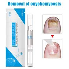 Горячая Распродажа, средство для ухода за ногтями, средство для ухода за ногтями, яркое питательное средство для чистки ног, здоровая ручка FRE