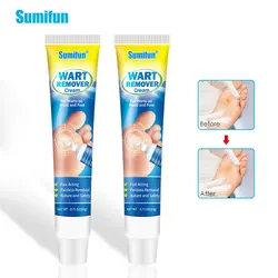 2Pcs Sumifun Herbal Warts Remover Ointment Wart Treatment Antibacterial Cream Herbs Skin Tags Removal Foot Corns Plaster P1333