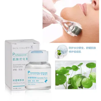 

Centella Asiatica face serum Liquid Acne Treatment 10 Ml Oil-Control Repair Smallpox Diluting Facial Ampoule Extract
