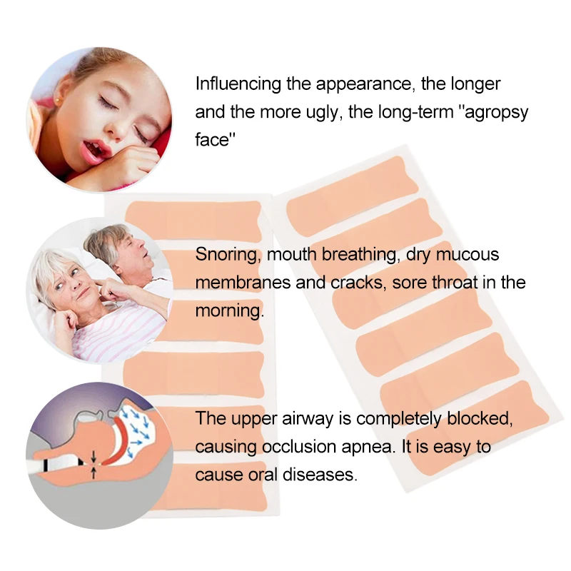 36Pcs Treatment Snoring Stickers To Stop Snoring And Talk In Sleep Artifact With Mouth Tape To Ease Sleep For Sleep Health C1664