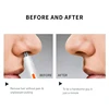 Nose Trimmer Mini Epilator for Nose & Ear Hair with USB Fast Charging Painless Dual-Edge Mute Motor Portable Electric Trimmer 5
