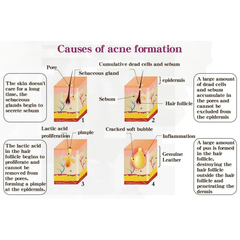 HTB1qZzNMgHqK1RjSZFgq6y7JXXa8