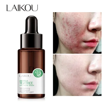 

LAIKOU Acne Treatment Serum Tea Tree Extract Essence Oil-control Anti-Aging Essence Anti Acne Scar Pimple Removal Skin Care