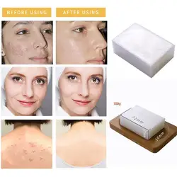 100g Handmade Natural Kojic Acid Remove Acne Soaps Smooth Facial Skin Wash Glutathione Cleanser Bath Whitening Soap Hand So Z5K4