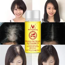 От выпадения волос продукты эффективный быстрый рост волос масляная эссенция масла жидкость для всех лечение волос TSLM2