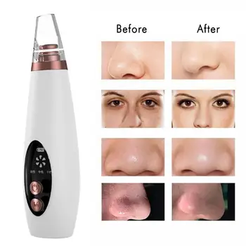 

6 In 1 Electric Blackhead Remover Pore Cleanser Vacuum Acne Suction Face Deeply Cleaning Rechargeable Instrument With 6 Suckers