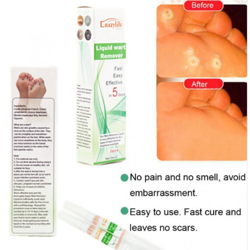 Remove Old Sputum To Remove Dead Skin Pen To Beautify Skin Care
