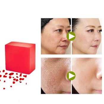 

Fast Closing Pores Acne Scar Repair Rough Skin Soften Handmade Plant Herb Soaps Whitening Face Lift Fishtail Lines Rose Soaps