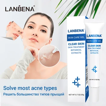 

LANBENA Acne Treatment Gel Acne Cleaning Cream Blackhead Remover Acne Spots Face Acne Scars Skin Care Repair Comedone Pimple