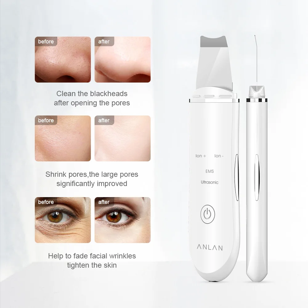ANLAN ultradźwiękowe urządzenie do oczyszczania twarzy, peeling, do czyszczenia porów, łopatka 3 ANLAN ultradźwiękowe urządzenie do oczyszczania twarzy, peeling, do czyszczenia porów, łopatka 3