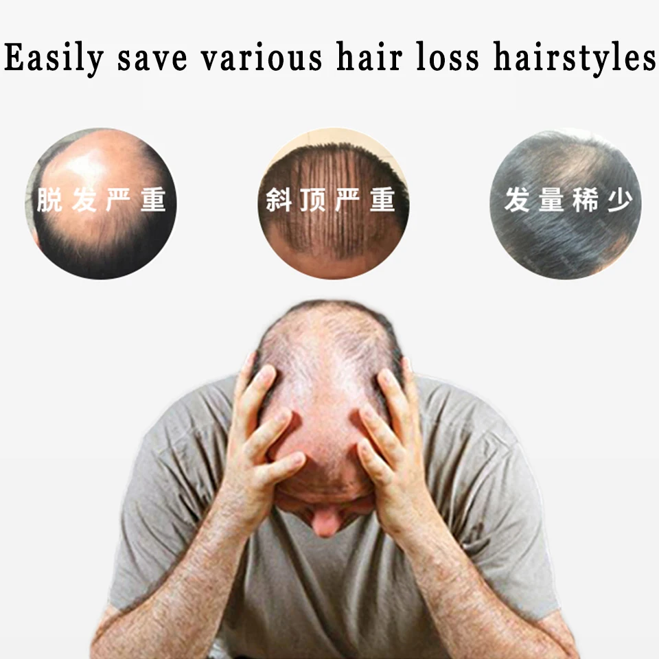 LUPU Short Synthetic Replacement Hair Extension Piece Fringe Top Closures Hairpins For Men Baldness Clip In Natural Fringe Hair