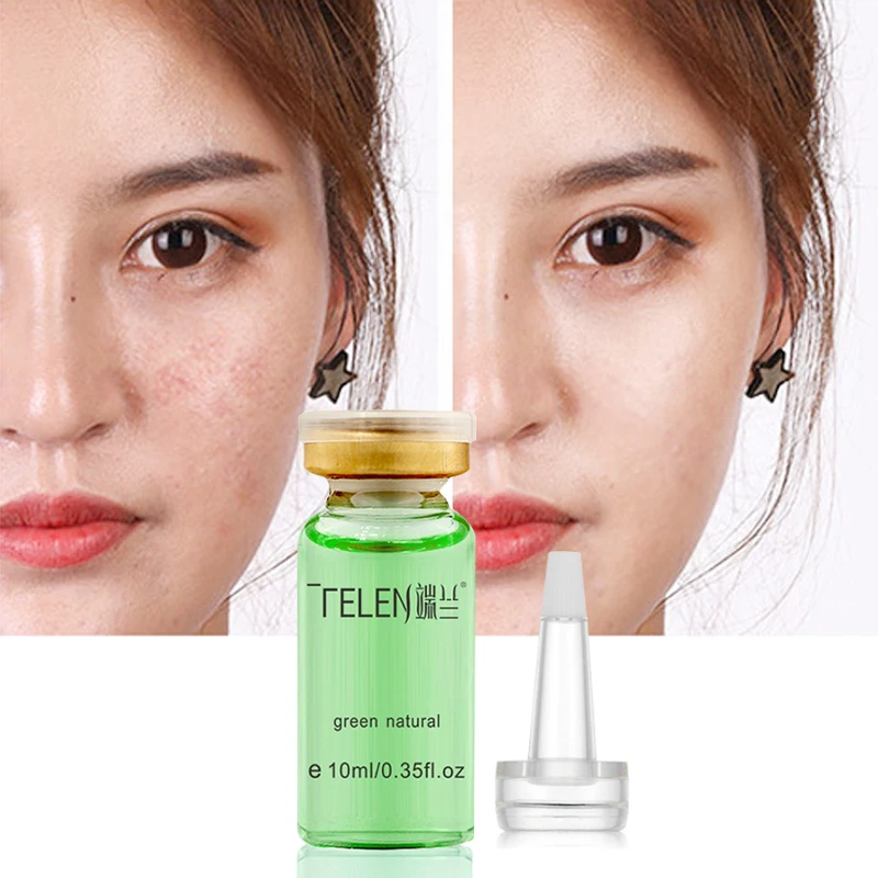 

100% Natural Tea Tree Essential Oil Anti-wrinkle Extract Acne Removal Scars Marks Treatment Essential Oil For Any Type Skin Care