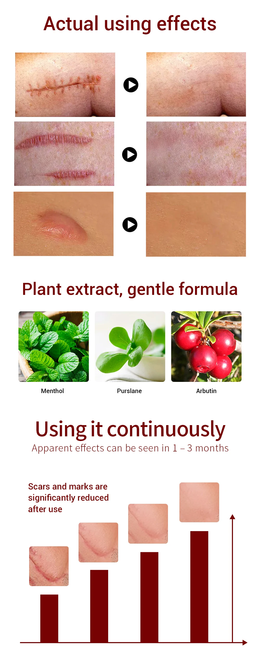 蓝贝那去疤霜_05