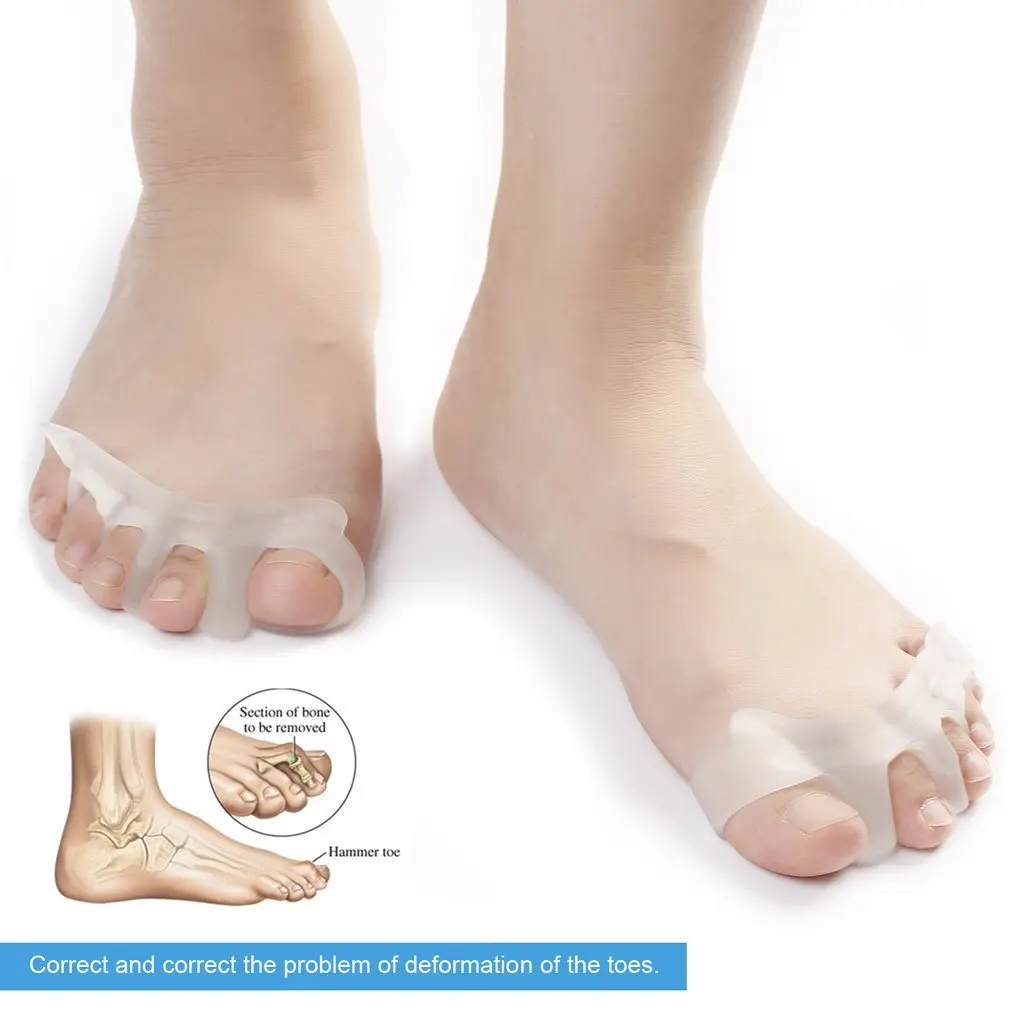 OUTAD гель-разделитель для пальцев ног bounion Relief Toe Выпрямитель для ног носилки для мужчин и женщин быстрое облегчение боли легкая одежда