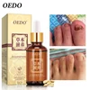 Herbal Fungal Nail Treatment Essential oil Hand and Foot Whitening Toe Nail Fungus Removal Infection Feet Care Polish Nail Gel ► Photo 3/6