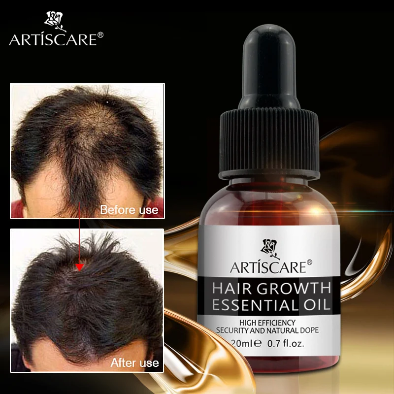 ARTISCARE Hair Growth Essential Oil Anti Hairs Loss Liquid Hair Repair