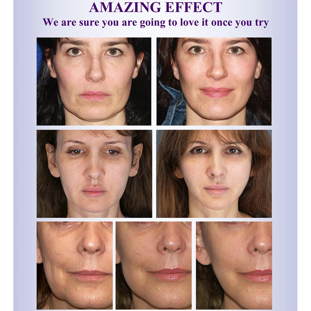 BREYLEE Essential Oils Rapid Firming Lifting Face Essence Oil Massage Anti Wrinkle Anti Aging Powerful V 4