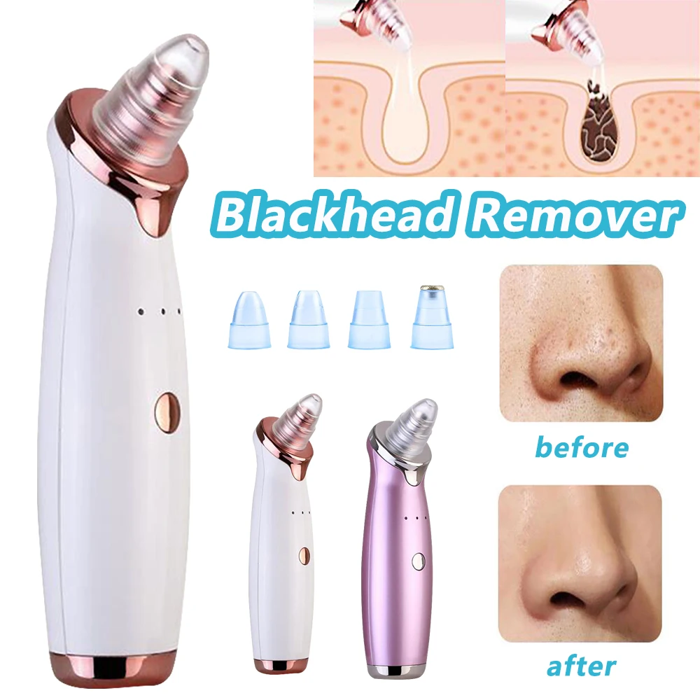Аппарат вакуумной чистки suction head. Derma suction 40 kpa vakumlu kullanimi. Derma suction насадки. Вакуумный аппарат для чистки лица. Дерма вакуум.