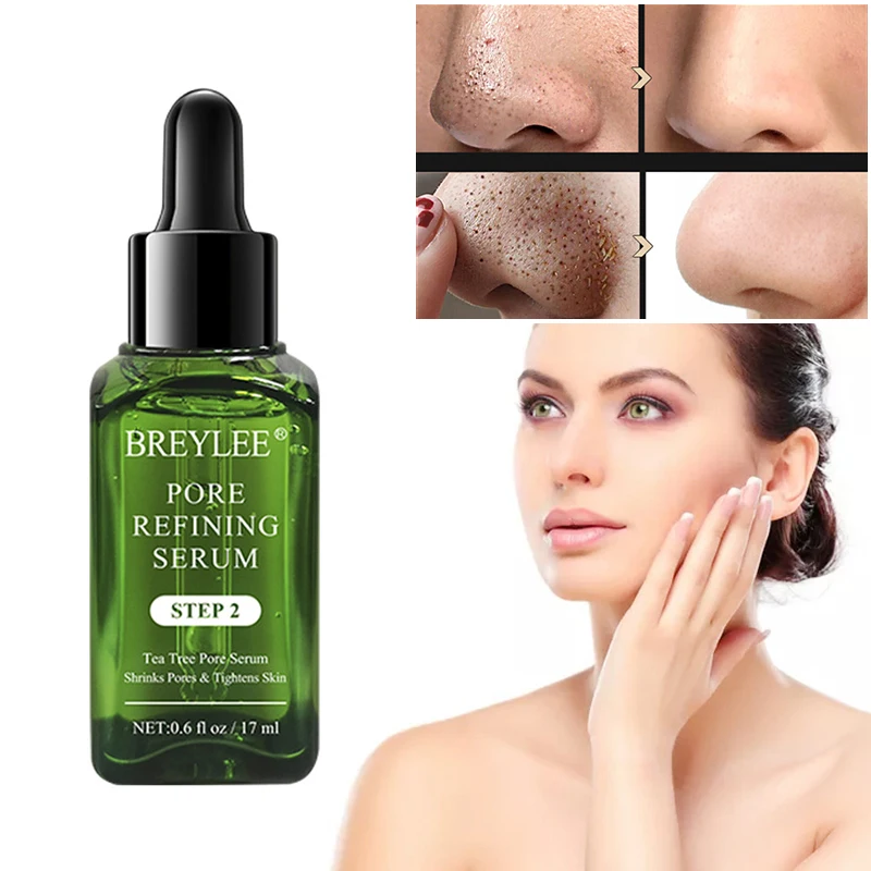 BREYLEE-suero para el tratamiento del acné, esencia para el rostro cicatriz de acné, cuidado de la piel Facial, blanqueamiento, reparación eficiente de poros, 1 unidad