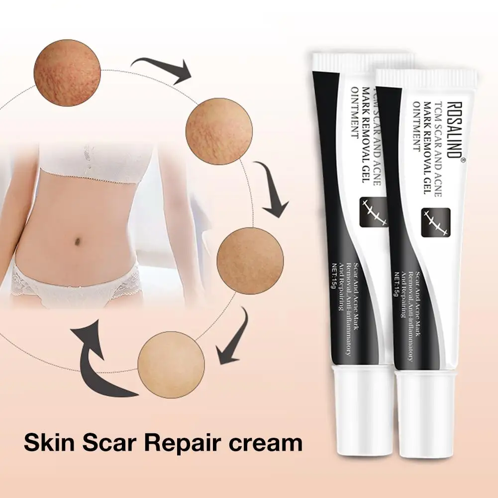 Repair Scar Cream Removal Acne Scars Gel Stretch Marks Surgical Scar Burn For Body Pigmentation Corrector 1 Repair Scar Cream Removal Acne Scars Gel Stretch Marks Surgical Scar Burn For Body Pigmentation Corrector 4