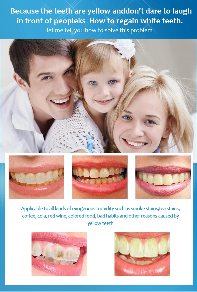White Teeth Whitening Gel Pen Dental Dentist Dentistry Tooth Gel Whitener Bleach Remove Stains Oral Hygiene 2