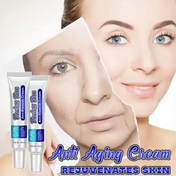

Natural Herbal Face Cream Face Pimples Scar Stretch Face Marks Skin Face Whiten Cream Care Treatment Acne Cream Removal X9D7