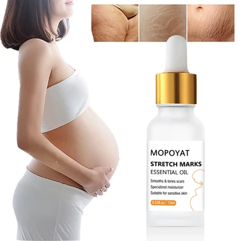 

Stretch Mark Remover Skin Care Essential oil Scar Cream From Stretch Marks Maternity Treatment Scar Repair Body Cream TSLM1