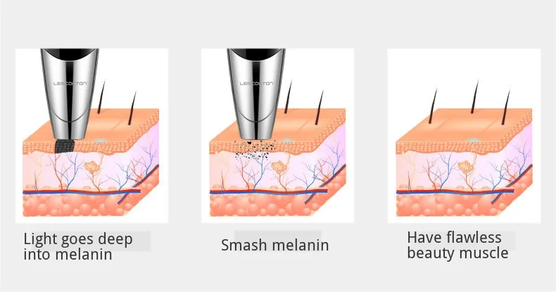 Removedor de Cravo Bateria Recarregável Portátil Handheld Laser Picosegundo Caneta Ponto Mole Clareamento Sarda Remoção Melanina 5 High Quality Beleza e saúde