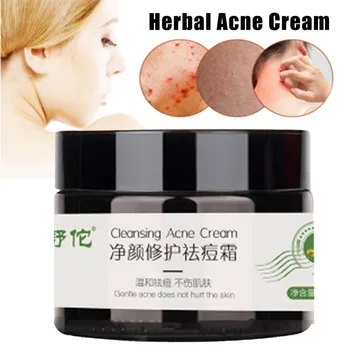 

2019 30g Acne Removal Cream Plant Extracts Cleansing Acne Cream Face Skin Care Treatment
