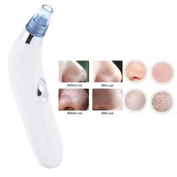 

Deep Clening Face Pore Vacuum Acne Pore Cleaner Pimple Removal Vacuum Suction Blackhead Black Dot Remover