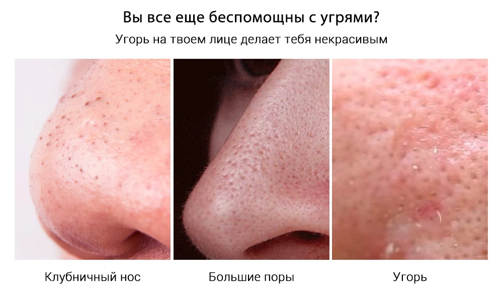 H6217aabf06a946aeaf816d8b7b286451g