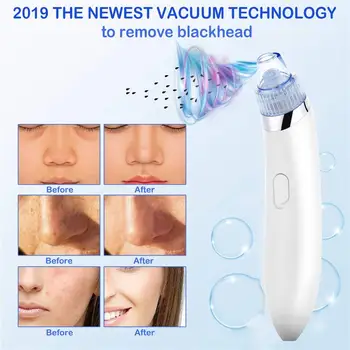 

Cosmetic Instrument Black Head Cleaner Blackhead Removal Equipment 2 Color ABS Fashion Fast Effective Remove Clean