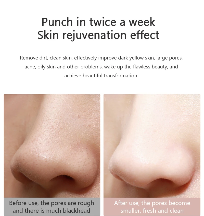 薇新清洁美肤黑头仪WX-HT100_15