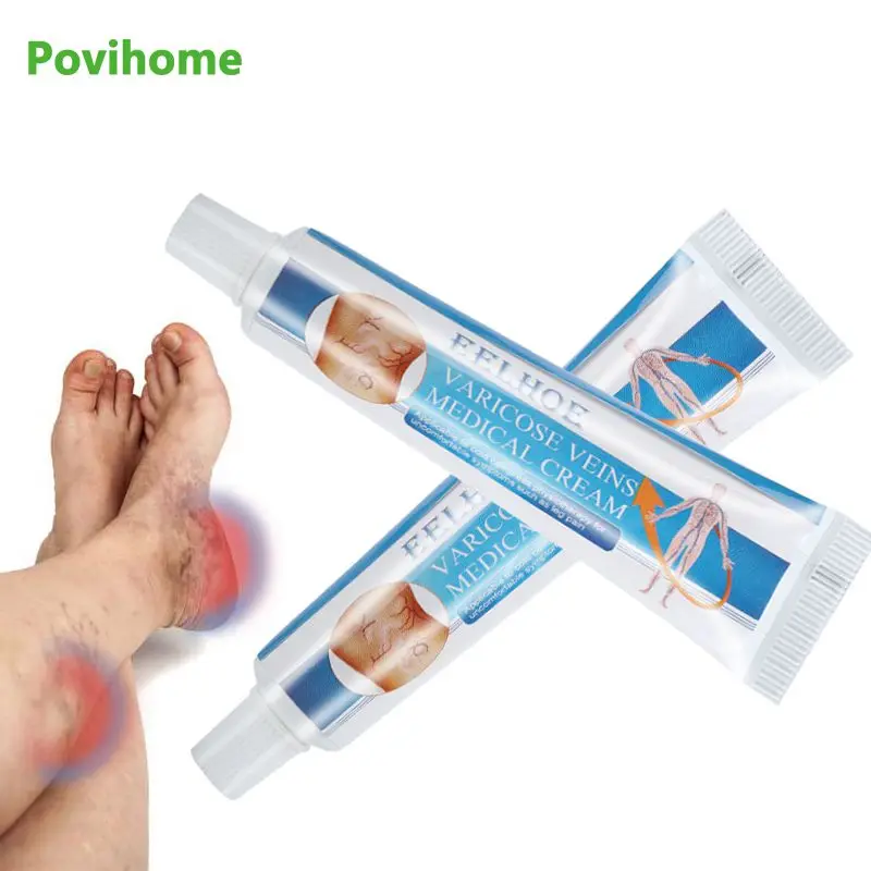 

1pcs Varicose Veins Treatment Cream Vasculitis Phlebitis Spider Ointment Varicosity Angiitis Removal Herbal Medical Plaster