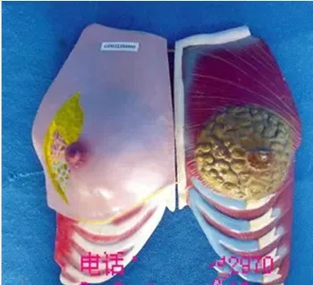 

Female Breast Model Health and Sick Breast Anatomy Model Female Genital Anatomical Model Pathological Breast Medical Teaching
