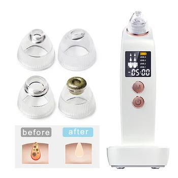

Electric Blackhead Remover Suction For Face Skin Care Tools Vacuum Acne Pore Black Dot Pimple Removal Facial Deep Nose Cleaner