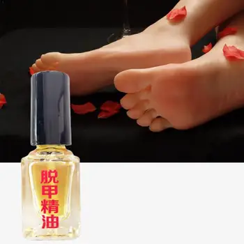 

3 Days Effect Fungus Removal Liquid Fungal Nail Treatment Foot Bright Nail Anti Onychomycosis Repair Infection Caring Q1P8