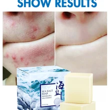 Морское мыло с солью Очиститель Удаление прыщей поры, акне лечение козы увлажняющее молочко уход за лицом мытье основа мыло основа уход за кожей